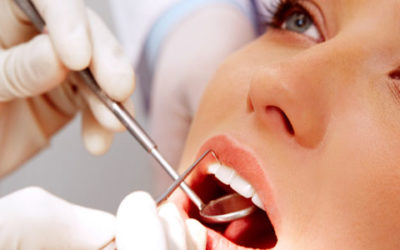 Tired of your amalgam fillings?