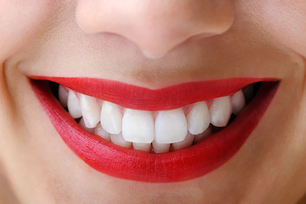 Image of a woman smiling with white teeth.